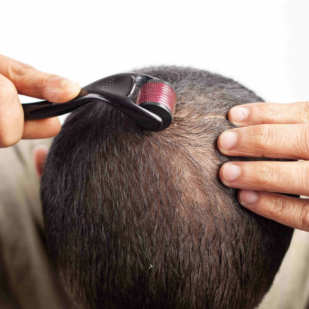 Dermaroller 540 — Barbe Dense & Cheveux Forts en 4 Semaines